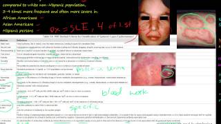 89P Systemic lupus erythematosus SLE how to diagnosis Etiology and Pathogenesis [upl. by Cirded]