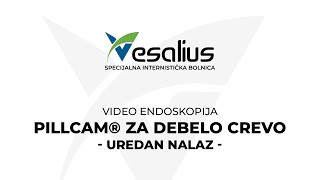 VESALIUS  PillCam® za debelo crevo Uredan nalaz Animacija [upl. by Crissie]