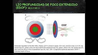 ABERRACIONES ÓPTICAS CLASES DE REFRACCIÓN DEL INO [upl. by Huberto]