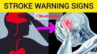 7 Warning Signs of Stroke One Month Before Unbelievable [upl. by Lipman830]