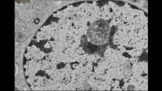 EUCHROMATIN and HETEROCHROMATINDNA [upl. by Lareneg]