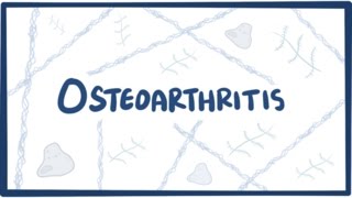 Osteoarthritis  causes symptoms diagnosis treatment amp pathology [upl. by Aneehta100]