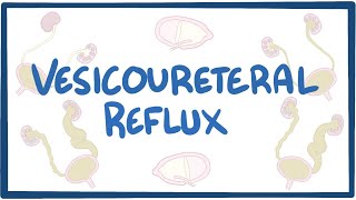 Vesicoureteral reflux  causes symptoms diagnosis treatment pathology [upl. by Dolores955]