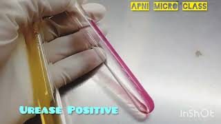 Urease test In Microbiology lab  How to read  Positive Urease reaction [upl. by Sofer]