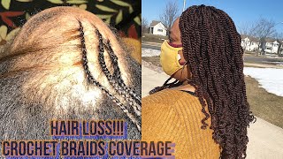 HAIR LOSS COVERAGE HOW TO DO CROCHET BRAIDS ON A NET [upl. by Etoile]