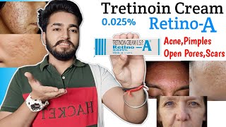 Retino A 0025 Cream Review  Tretinoin Cream Review [upl. by Kristel]