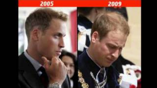 Prince Williams beauty before  after Kate in pictures [upl. by Aihtak]