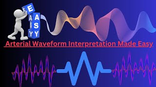 Arterial Waveform Interpretation Made Easy [upl. by Aivekahs190]