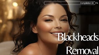 Skincare  Blackheads Removal 032 blackheads blackheads skincare [upl. by Radcliffe631]