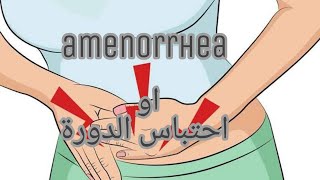 أسباب احتباس الدورة الشهرية وكيفية علاجه🔥مهم جدااااا [upl. by Nesahc123]