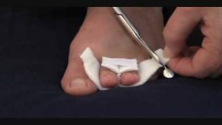 Tips For Buying A Toe Digit Wrap  MYFOOTSHOPCOM [upl. by Narot695]