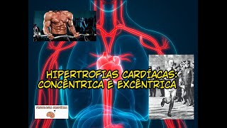 DIFERENÇAS ENTRE AS HIPERTROFIAS CARDÍACAS CONCÊNTRICA E EXCÊNTRICA [upl. by Cello]