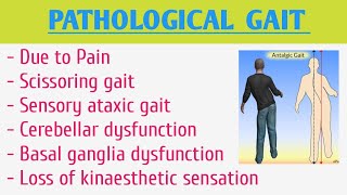 Pathological Gait [upl. by Enait]