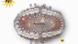 PDT Furcation chart showing all furcations and how to measure [upl. by Leighland]