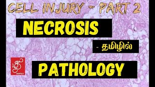 NECROSIS  IN TAMIL GENERAL PATHOLOGY [upl. by Sina]