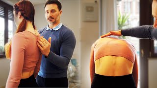 I Couldnt Believe the Transformation Before amp After a Scoliosis Treatment [upl. by Petulah]