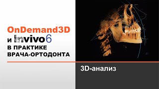 Invivo 6 и OnDemand3D Dental в практике врачаортодонта 3Dанализ [upl. by Nesila128]