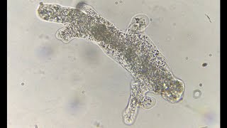 Amoeba movement with pseudopodia under a microscope [upl. by Seek177]