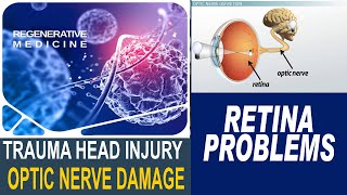 TRAUMA HEAD INJURY  OPTIC NERVE DAMAGE [upl. by Airottiv207]