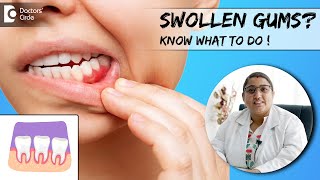 HOW TO STOP GUM DISEASE AND BLEEDING AT HOME Fix Gingivitis And Gum Pain 5 Simple Steps [upl. by Seadon]