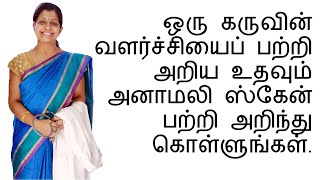 ஒரு கருவின் வளர்ச்சியைப் பற்றி அறிய உதவும் அனாமலி ஸ்கேன் பற்றி அறிந்து கொள்ளுங்கள் [upl. by Fe]