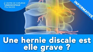 HERNIE DISCALE  Estelle grave [upl. by Sears497]