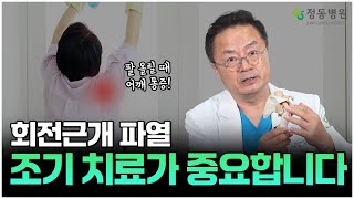 스포츠 취미생활이신 분들은 주목 회전근개파열 조기치료해야 하는 이유 [upl. by Munro141]