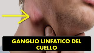 CRECIMIENTO DE GANGLIOS LINFÁTICOS EN LA REGIÓN DEL CUELLO ¿CAUSAS Y TRATAMIENTO [upl. by Eelyma376]