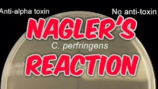 Naglers reaction clostridium perfringens in hindi [upl. by Doone]