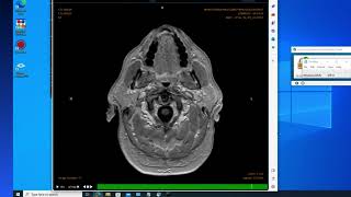 Remote Radiology VPN Showdown  Zscaler [upl. by Aizatsana69]