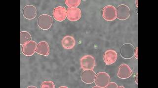 Babesia bovis merozoite egress from a red blood cell [upl. by Darom470]