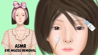 【ASMR】Satisfying Eye Mucus Discharge Removal 눈 점액 제거 目の粘液の除去 眼睛粘液去除 [upl. by Flory363]