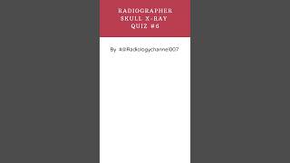 skull XRay Quiz 6 radiologychannel007 [upl. by Iredale650]