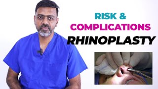 The Risks of Rhinoplasty Everything You Need To Know [upl. by Jankey]