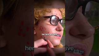 Anxious Teen Had So Much Acne So She Had A Makeover 💄 [upl. by Enneles]