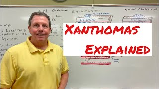 Xanthoma A Simple Explanation [upl. by Mccutcheon212]