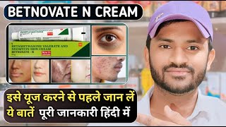 Betnovate n cream uses benefits and side effects full review in hindi [upl. by Philbrook]