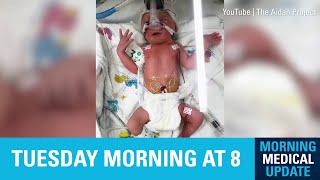 Morning Medical Update  Neonatal Medical Home [upl. by Pryce]