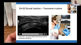 Techniques surrounding ultrasound guided injections basic and advanced [upl. by Aileme]