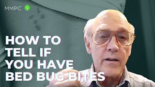 How To Identify Bed Bug Bites  Can Doctors or Exterminators Identify Bed Bug Bites [upl. by Alberto]