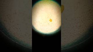 Abnormal sperm with head defect abnormal sperm viralvideo medical doctor sssss mlt [upl. by Lyred]