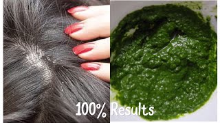 BEST SEBORRHEIC DERMATITIS SCALP TREATMENT  AYURVEDIC DANDRUFF TREATMENT 100 RESULTS IN ONE USE [upl. by Ayatnwahs]