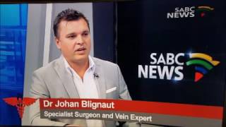 Varicose veins discussion on SABC Health Matters August 2016 [upl. by Broucek]