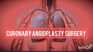 Angioplasty Procedure Animation Video  coronary angioplasty surgery  angioplasty surgery [upl. by Bandur]