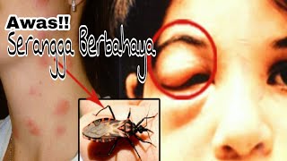 Jauhi Serangga ini Genus Triatoma Serangga Penghisap Darah duniaserangga Eps 1 [upl. by Glovsky]