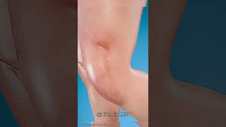 Como substituir ligamentos rompidos 😯curiosidades curiosidade fatos vocesabia [upl. by Cherianne654]