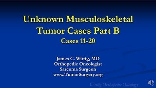 Orthopedic Oncology Course  Unknown Test Cases Part B Cases 1120  Lecture 12 [upl. by Enowtna]