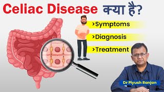 Celiac Disease क्या है जाने इस बिमारी के लक्षण  Diagnosis and Treatment  Foods to avoid in Celiac [upl. by Akcir]