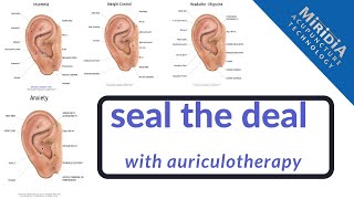 How to Treat Patients with Auriculotherapy for Acupuncturists Chiropractors and More [upl. by Omixam961]