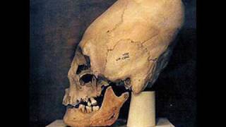 Confirmation that Elongated  Conehead skulls from Peru and elsewhere are extraterrestrial fossils [upl. by Nosoj56]